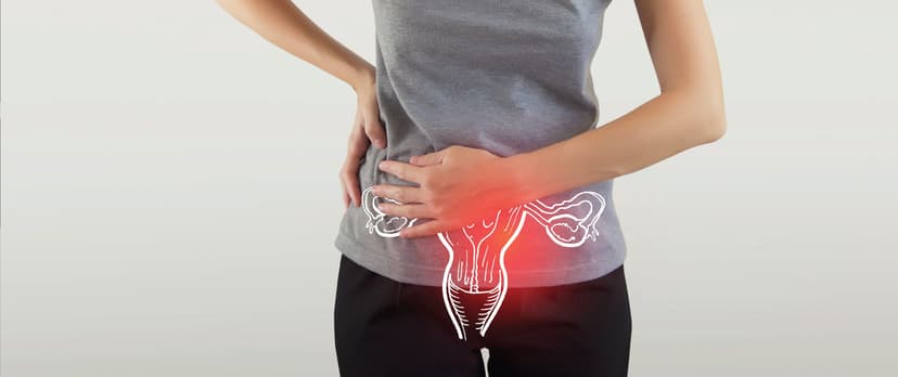 Polycystic Ovary Syndrome (PCOS): Symptoms, Causes, And Treatment Options