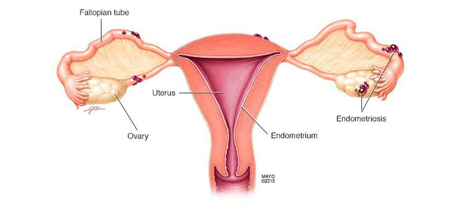 ovulation-induction