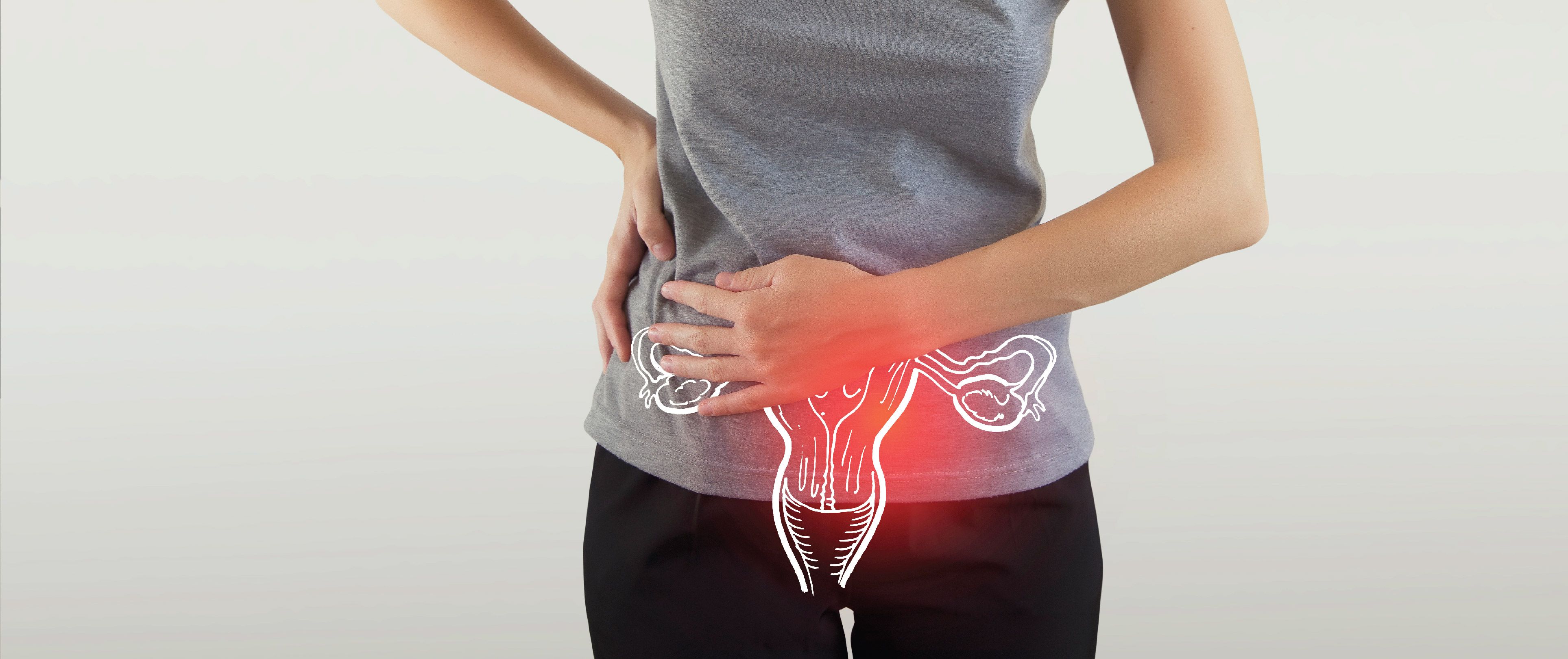 Polycystic Ovary Syndrome (PCOS): Symptoms, Causes, And Treatment Options
